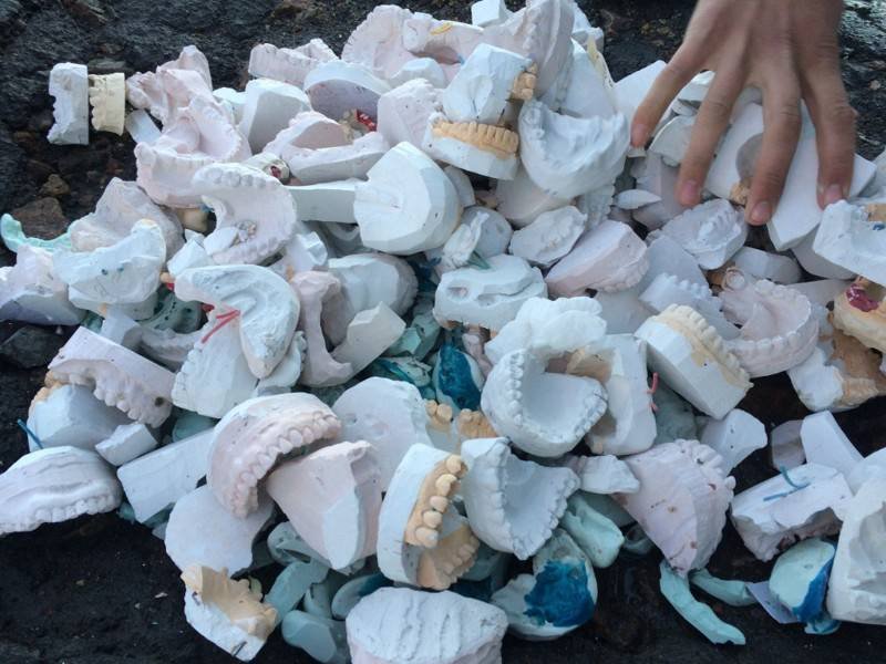 Стоматологи Барнаула залатали дорожные ямы зубами