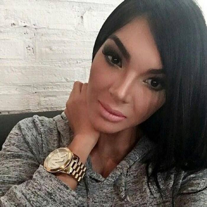 Ради идеальной внешности этой девушке вырвали все зубы