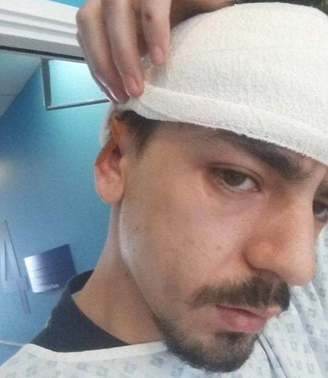Любитель недожаренных стейков сожрал ухо собеседника